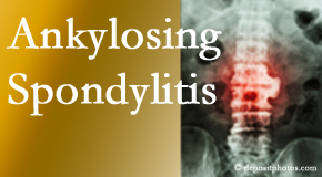 Ankylosing spondylitis is gently cared for by your Manahawkin chiropractor.
