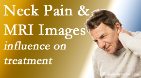 Manahawkin Chiropractic Center considers MRI findings like Modic Changes when setting up a neck pain relieving treatment plan.