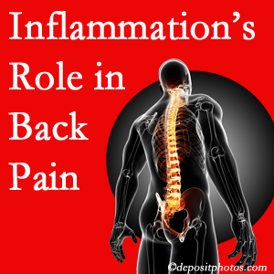 The role of inflammation in Manahawkin back pain is real. Chiropractic care can manage it.