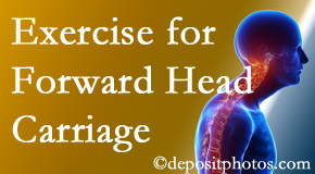 Manahawkin chiropractic treatment of forward head carriage is two-fold: manipulation and exercise.