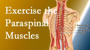 Manahawkin Chiropractic Center describes the importance of paraspinal muscles and their strength for Manahawkin back pain relief.