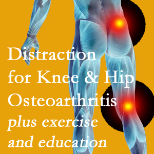 A chiropractic treatment plan for Manahawkin knee pain and hip pain due to osteoarthritis: education, exercise, distraction.