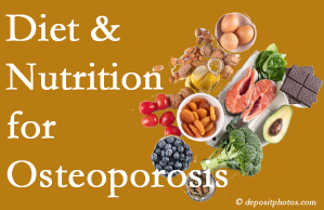Manahawkin osteoporosis prevention tips from your chiropractor include improved diet and nutrition and decreased sodium, bad fats, and sugar intake. 