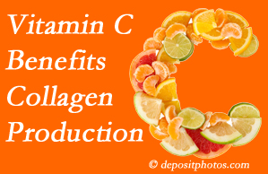 Manahawkin chiropractic offers tips on nutrition like vitamin C for boosting collagen production that decreases in musculoskeletal conditions.
