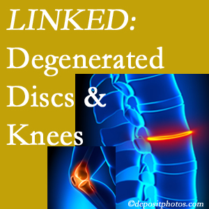 Degenerated discs and degenerated knees are not such unlikely companions. They are seen to be related. Manahawkin patients with a loss of disc height due to disc degeneration often also have knee pain related to degeneration.  