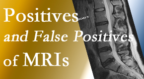 Manahawkin Chiropractic Center carefully decides when and if MRI images are needed to guide the Manahawkin chiropractic treatment plan. 