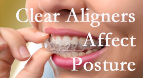 Clear aligners influence posture which Manahawkin chiropractic helps.