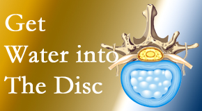 Manahawkin Chiropractic Center uses spinal manipulation and exercise to enhance the diffusion of water into the disc which supports the health of the disc.