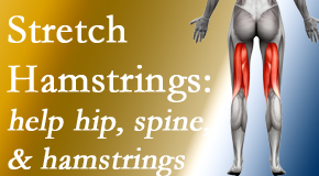 Manahawkin Chiropractic Center encourages back pain patients to stretch hamstrings for length, range of motion and flexibility to support the spine.