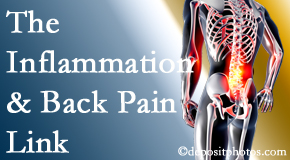 Manahawkin Chiropractic Center addresses the inflammatory process that accompanies back pain as well as the pain itself.