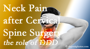 Manahawkin Chiropractic Center offers gentle care for neck pain after neck surgery.