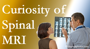 Manahawkin MRIs for spinal stenosis may be revealing…or puzzling.