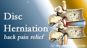 Manahawkin Chiropractic Center offers non-surgical treatment for relief of disc herniation related back pain. 