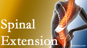 Manahawkin Chiropractic Center understands the role of extension in spinal motion, its necessity, its benefits and potential harmful effects. 