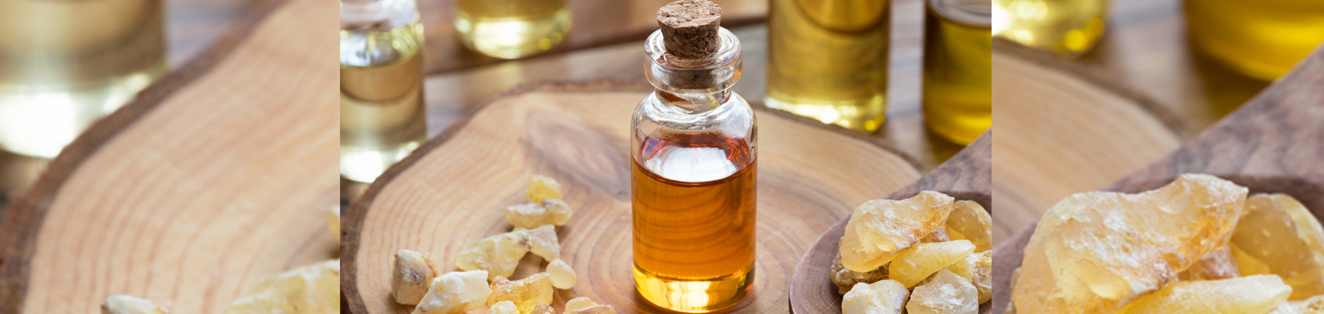 Manahawkin anti-inflammatory frankincense
