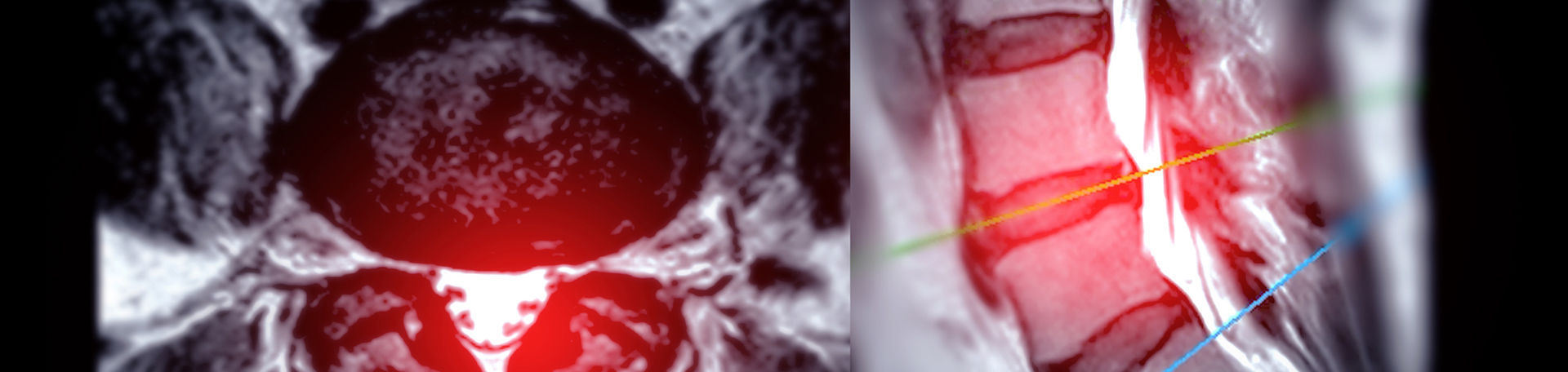 Manahawkin back pain imaging and exercise