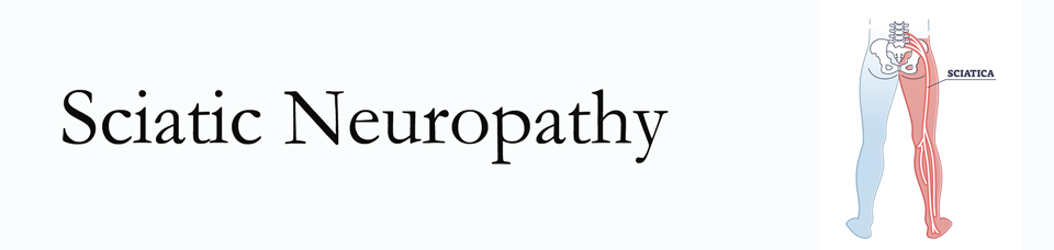 Manahawkin neuropathy pain (sciatica) 