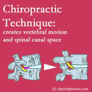 picture of a tight spinal canal area