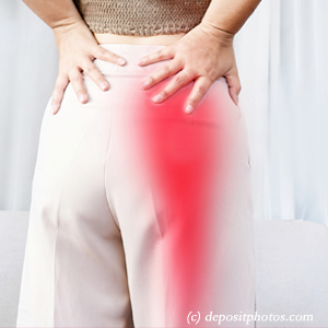 picture of Manahawkin leg pain, sciatica, lumbar radiculopathy