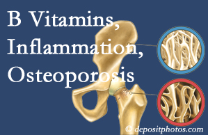 Manahawkin chiropractic care of osteoporosis often comes with nutritional tips like b vitamins for inflammation reduction and for prevention.