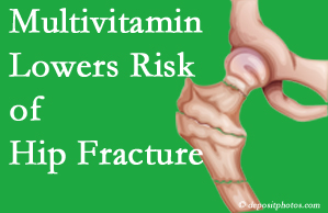 Manahawkin hip fracture risk is reduced by multivitamin supplementation. 