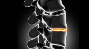 Manahawkin chiropractic nutrition with vitamin D and quercitrin