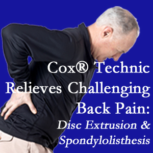 Manahawkin chiropractic care with Cox Technic relieves back pain due to a painful combination of a disc extrusion and a spondylolytic spondylolisthesis.